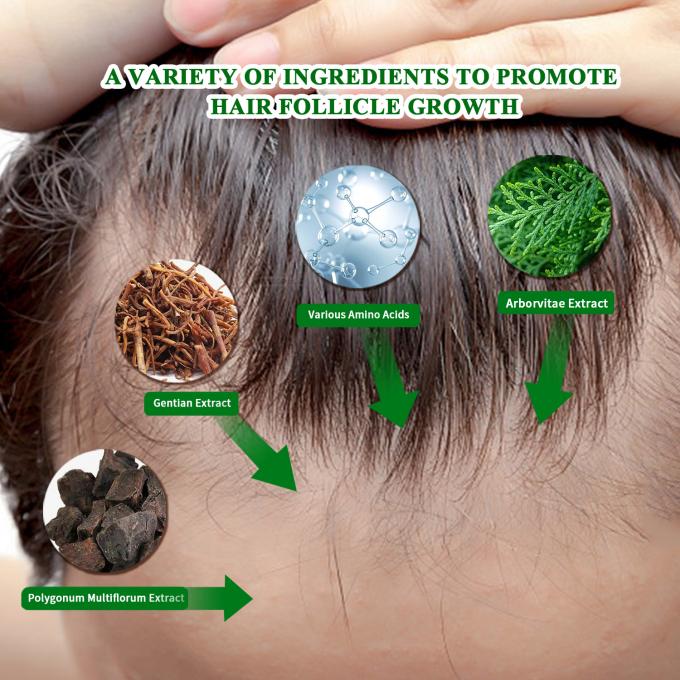 เซรั่มการเติบโตผมอินทรีย์ การใช้ภายนอก การรักษาการเติบโตของผม Anti Hair Loss Spray 80ml 0
