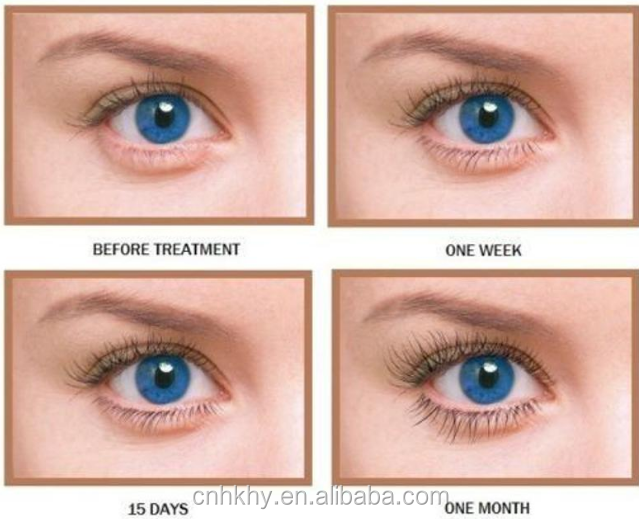 ประสบการณ์ระยะยาวของสายตาด้วย Bio-enzyme การเจริญเติบโตของสายตา เซรั่มอายุการใช้งาน 3 ปี 1