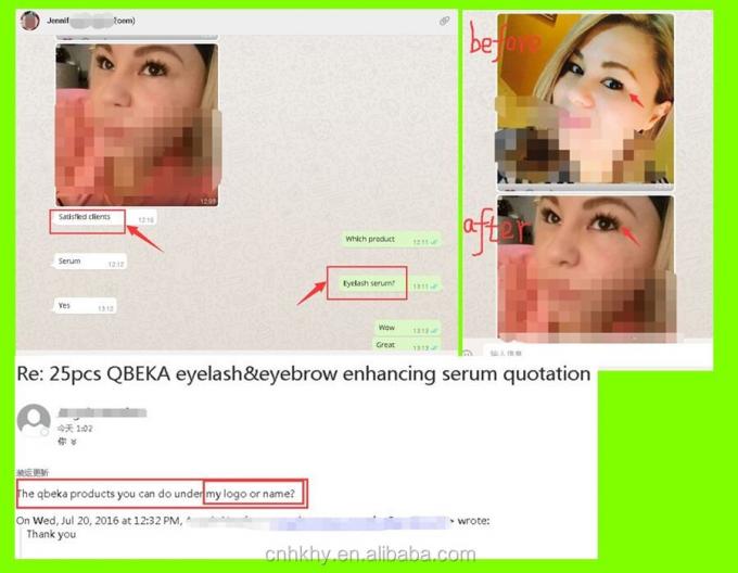 ประสบการณ์ระยะยาวของสายตาด้วย Bio-enzyme การเจริญเติบโตของสายตา เซรั่มอายุการใช้งาน 3 ปี 2