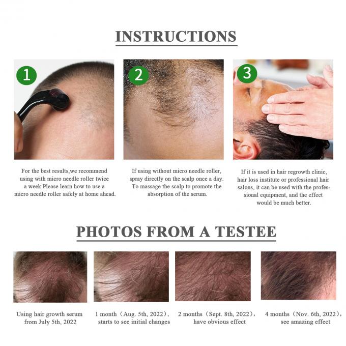 สัมผัสพลังของการรักษาป้องกันการสูญเสียผมของเราสําหรับบ้านและเพิ่มการเจริญเติบโตของผม 3