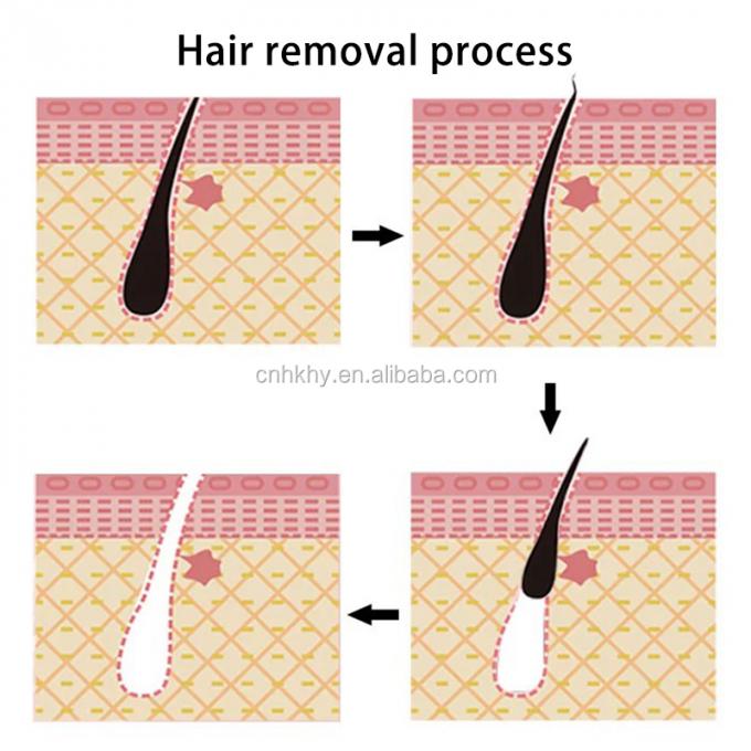 สารสกัดจากสมุนไพรสําหรับผิวที่อ่อนไหว สารสกัดจากสมุนไพร สูตร Aloe Smell Gentle 5