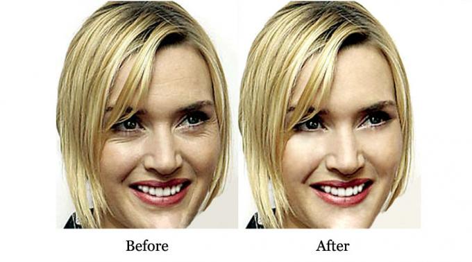 อายุการใช้งาน 3 ปี OEM stem cell และเพปติด Anti wrinkle Anti aging Skin คอลลาเจนบริสุทธิ์ เซรั่มหน้า 4