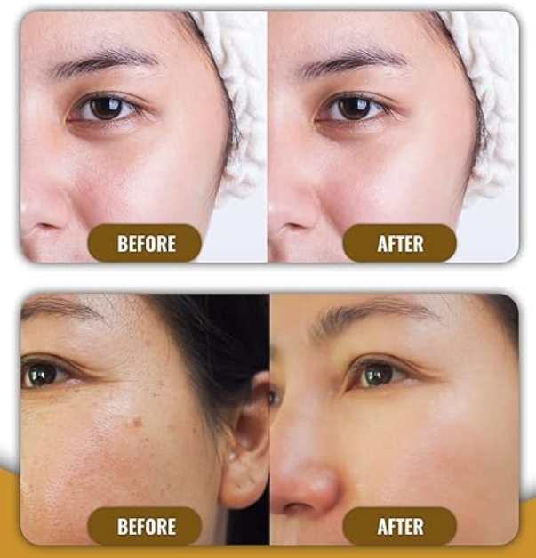 หน้ากากสีทอง 24K ของอินทรีย์ สําหรับบ้าน เจลที่ทําให้สบายใจ 7