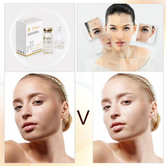 ขนาดปกติ วิตามินซีอินทรีย์ การทําความสะอาด การขาว Anti Freckles Ampoules จํานวน 1000 1