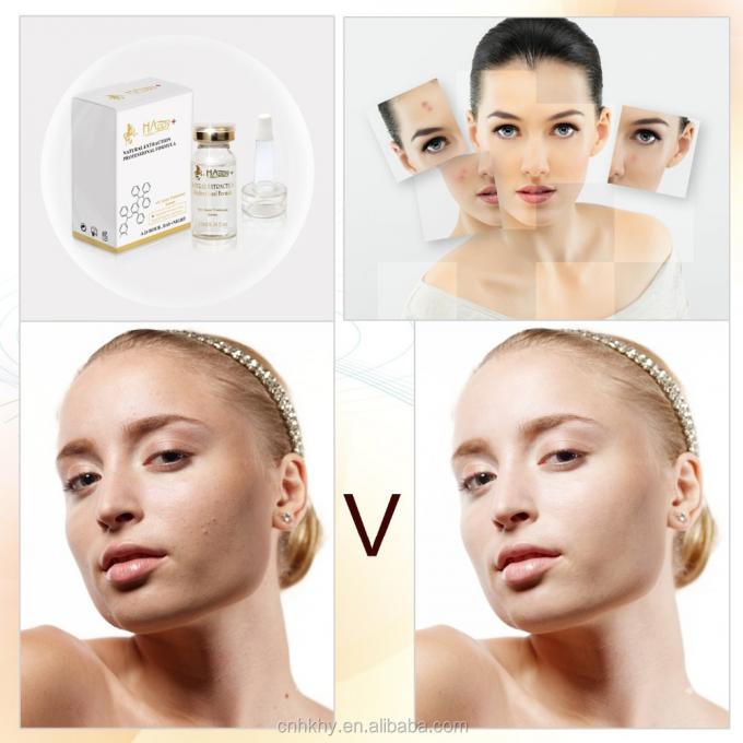 กําจัดริ้วรอยฝ้ากระ ด้วย QBEKA Happy Cosmetics Levorotatory VC สารชีวสารเหลวแท้ 0